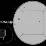 Artech Ultrasonic Screening